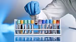 Sağlık ve bakım alanında uzman evde bakım hizmetleri, kan testi ve laboratuvar hizmetleri.